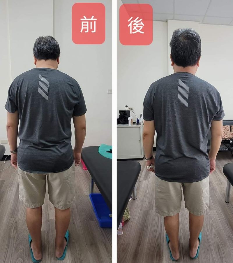 元強仙骨微調